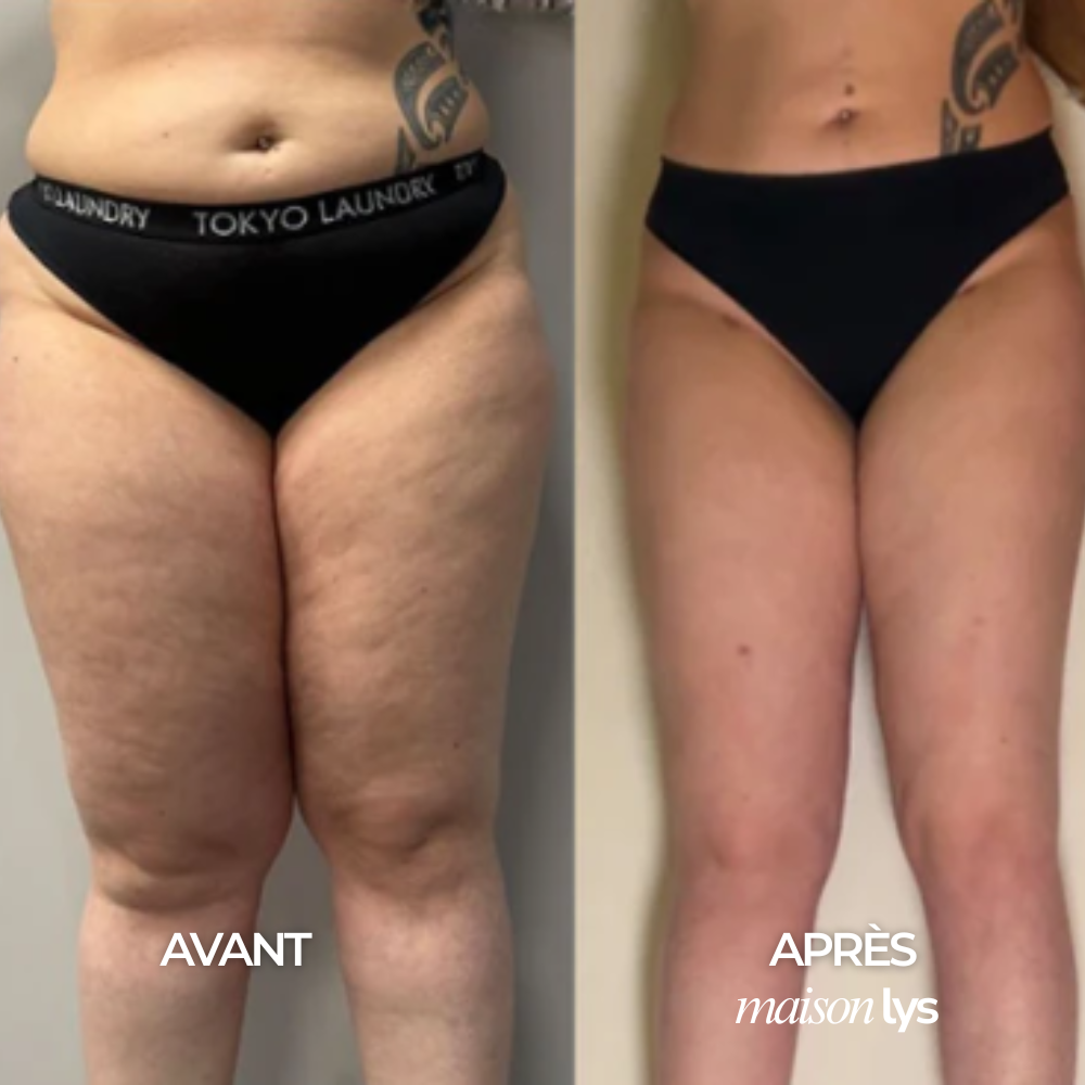 Gouttes Bien-Être Drainage Lymphatique