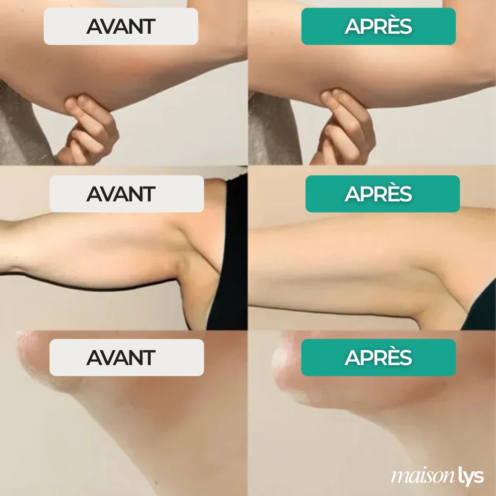 Gouttes Bien-Être Drainage Lymphatique