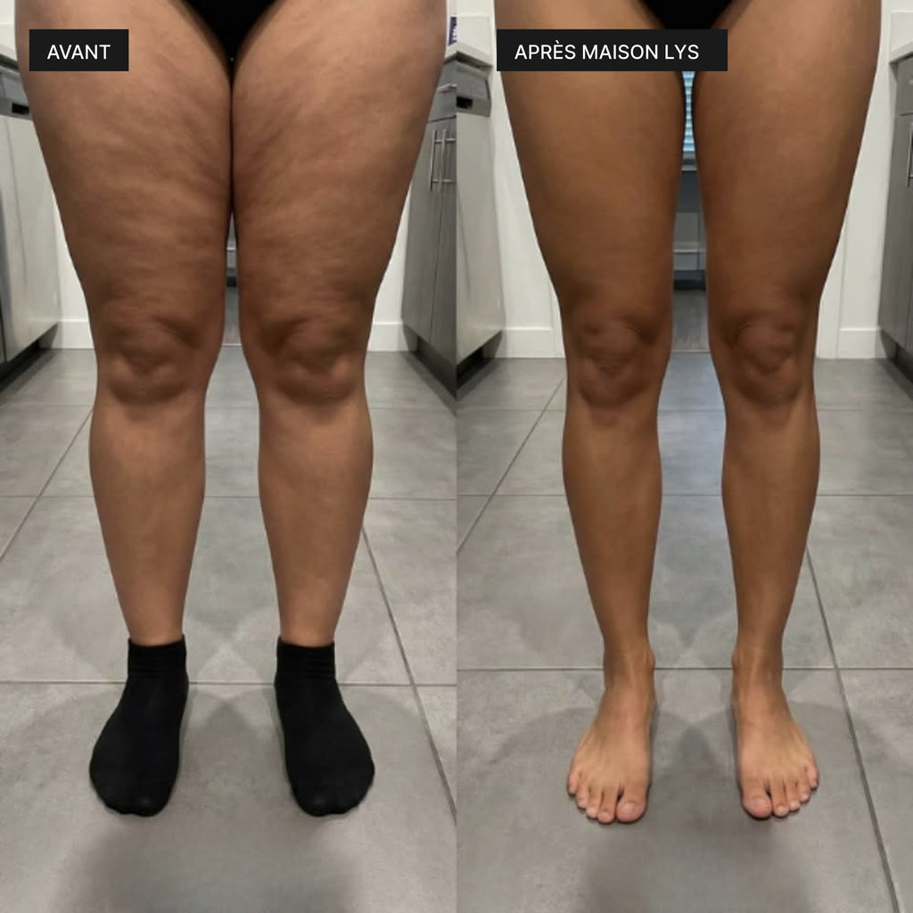 Avant après, jambes et cuisses