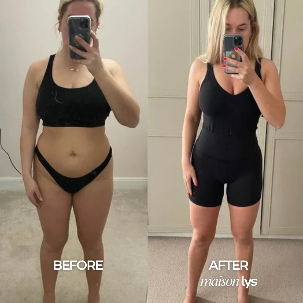 Before and after