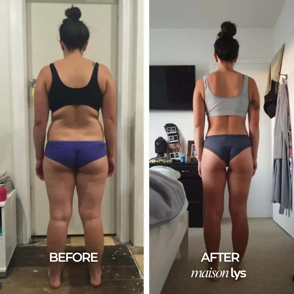 Before and after