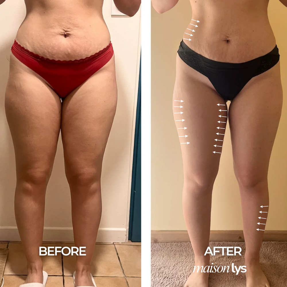 Before and after