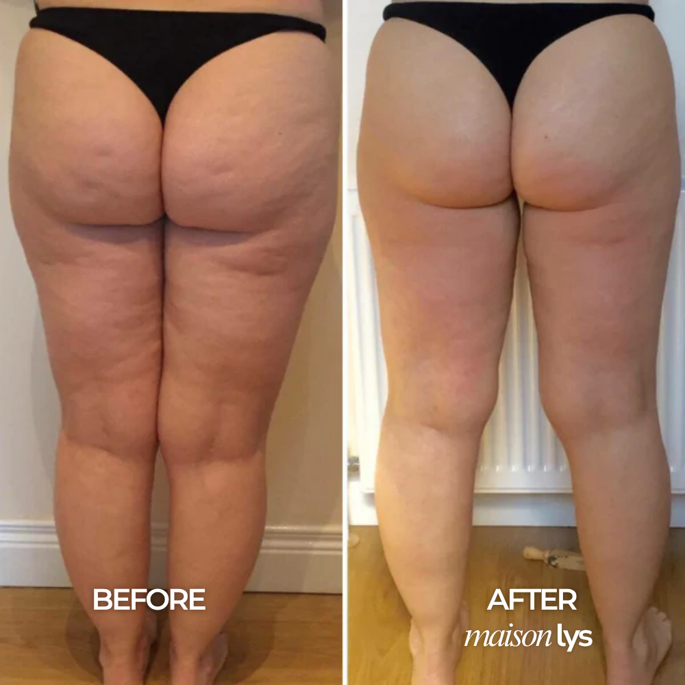 Before and after