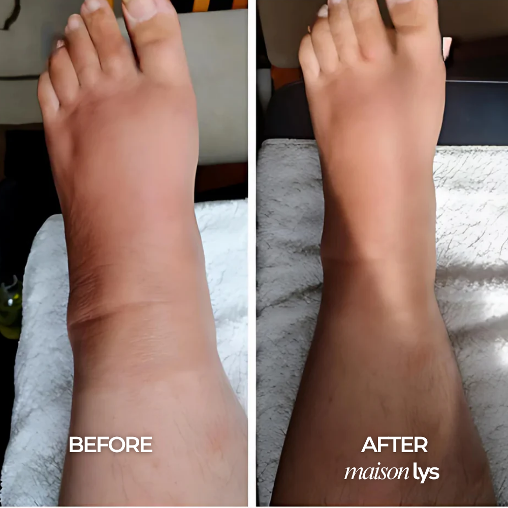 Before and after
