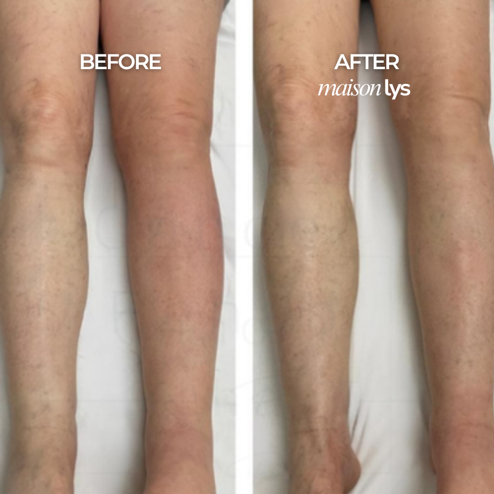 Before and after