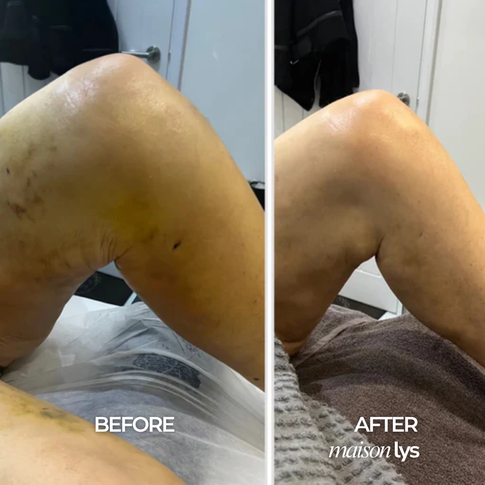 Before and after