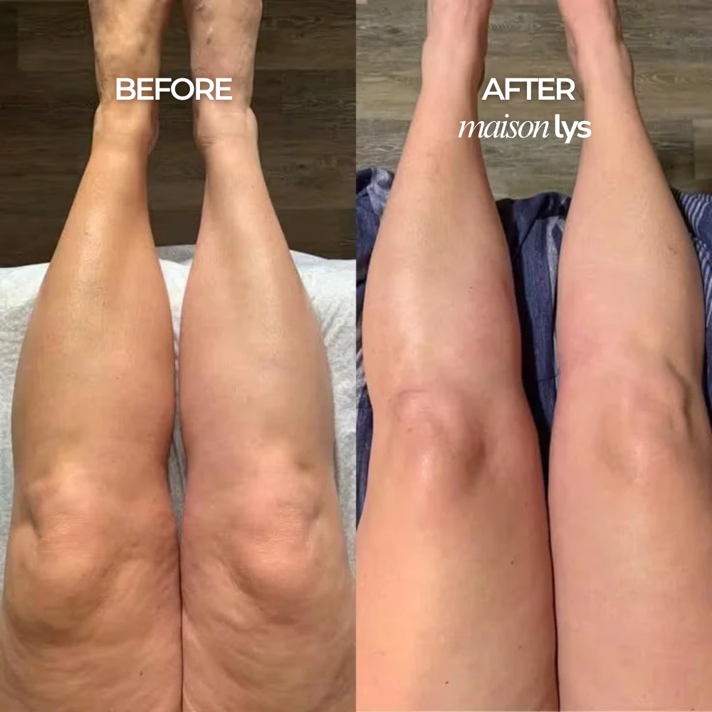 Before and after