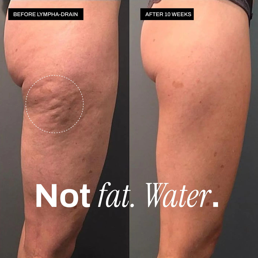 Before and after — legs